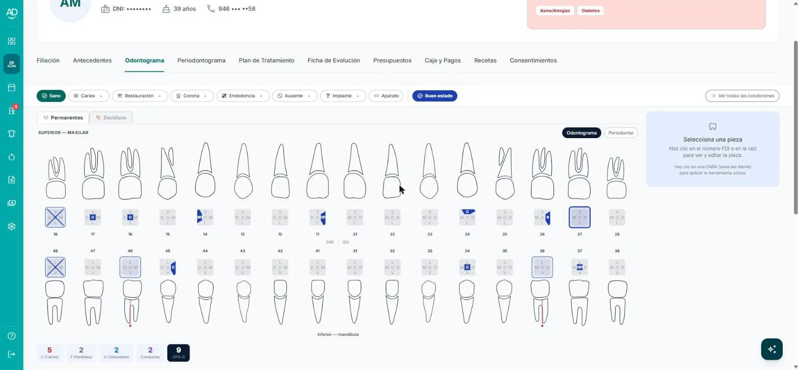 Odontograma de AmperDent con hallazgos y tratamientos registrados sobre el diagrama dental.